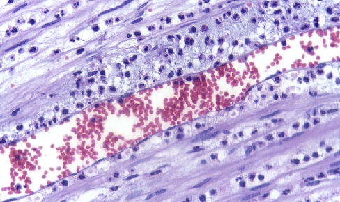 Neutrophils